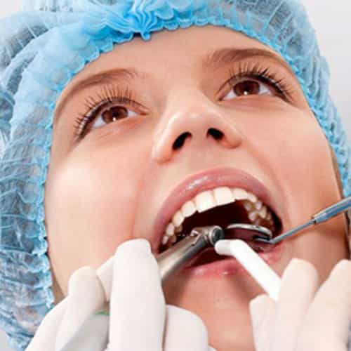 Dental Veneers in Mexico - Best Clinics, Dentists, and Packages